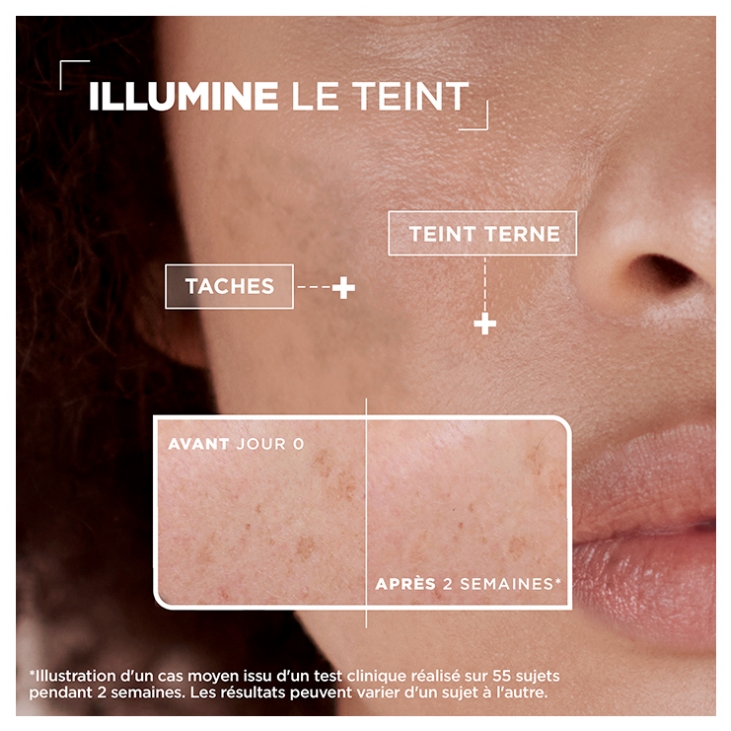 Mixa Sérum Anti-Taches Vitamine C + Acide Glycolique - 30 ml — vue 5